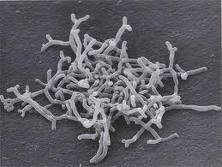 Bifidobacterium longum