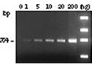 Taq DNA polymerase (recombinant)