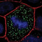 Human keratinocyte cell line